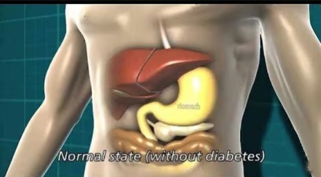 “Diabetes: The Silent Storm—A Global Wake-Up Call to Save Humanity”
